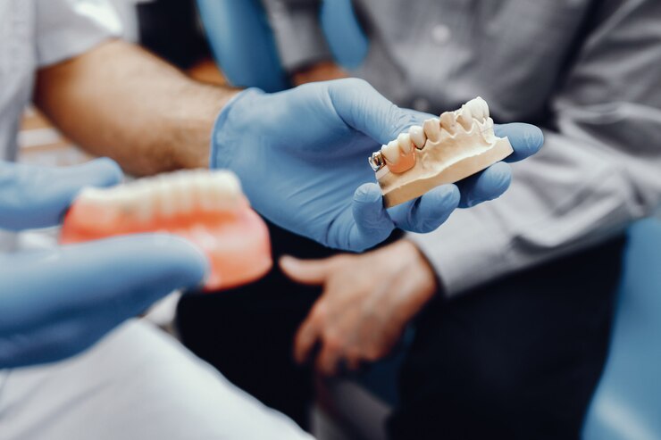 a dentist is holding dental bridges