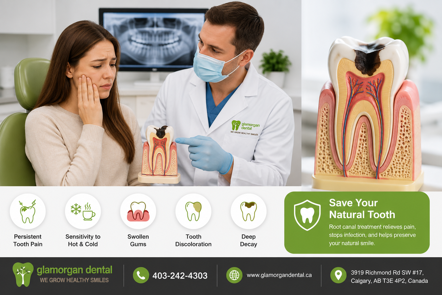 do i really need a root canal signs you shouldnt ignore