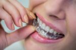 a lady is putting mouth guard on her teeth