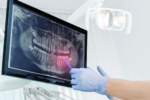 understanding dental x-rays